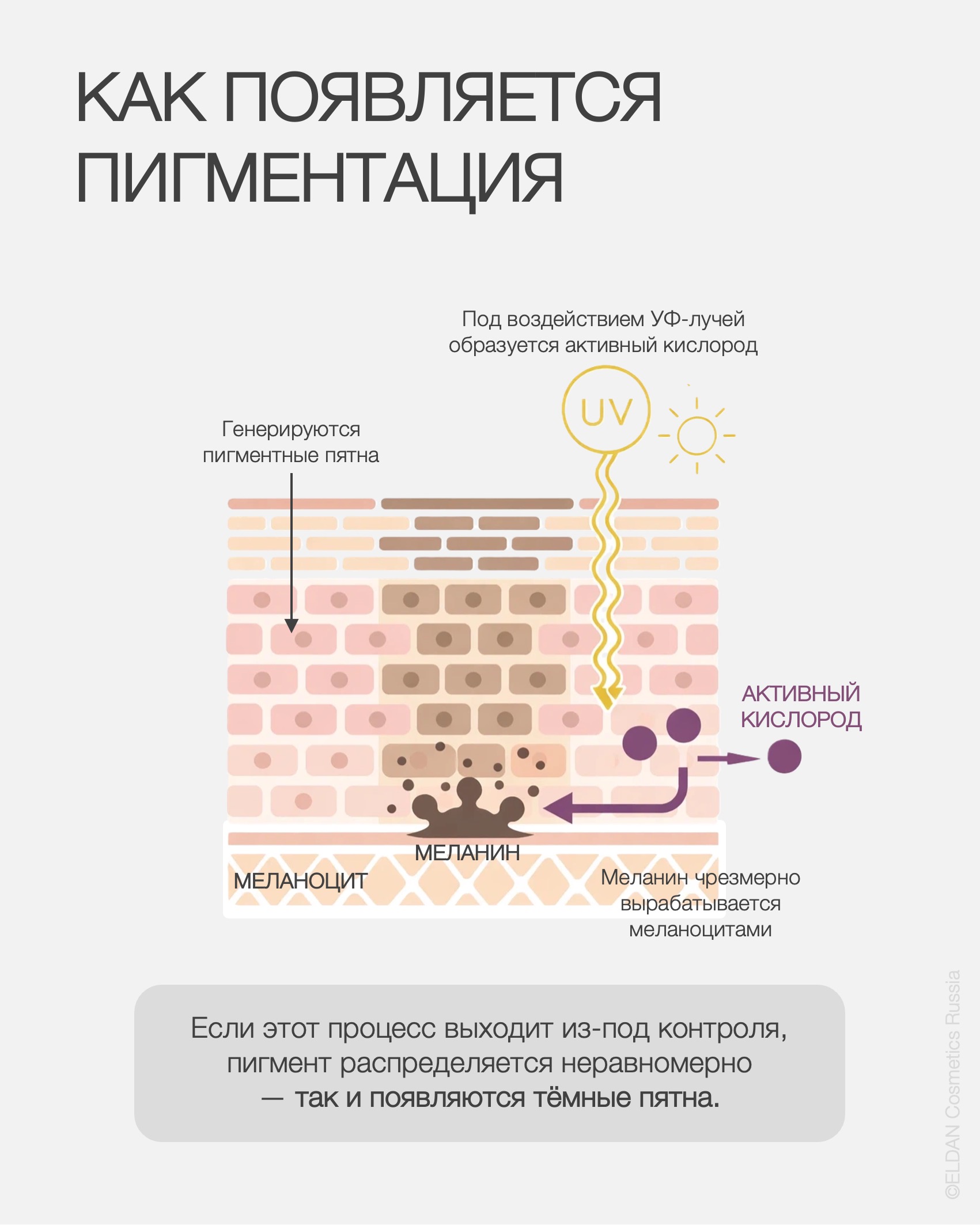Пост пигментация весной 3.jpg